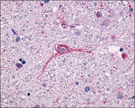 Anti-NTSR1 antibody produced in rabbit affinity isolated antibody