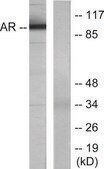Anti-Androgen Receptor antibody produced in rabbit affinity isolated antibody