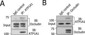 Anti-Na+/K+ ATPase &#945;-1 Antibody, clone C464.6 clone C464.6, Upstate&#174;, from mouse
