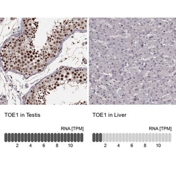 Anti-TOE1 antibody produced in rabbit Prestige Antibodies&#174; Powered by Atlas Antibodies, affinity isolated antibody, buffered aqueous glycerol solution