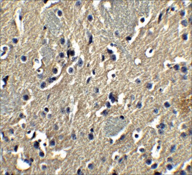 Anti-PION antibody produced in rabbit affinity isolated antibody, buffered aqueous solution