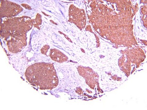 Anti-Hypoxia Inducible Factor 1 &#945; Antibody, clone H1&#945;67 clone H1alpha67, Chemicon&#174;, from mouse