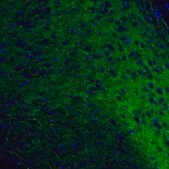 Anti-OPRM1 antibody produced in rabbit Prestige Antibodies&#174; Powered by Atlas Antibodies, affinity isolated antibody, buffered aqueous glycerol solution