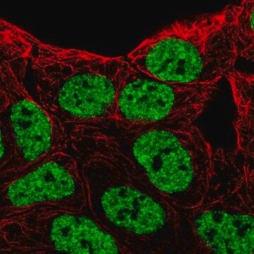 Anti-EPHB6 antibody produced in rabbit Prestige Antibodies&#174; Powered by Atlas Antibodies, affinity isolated antibody