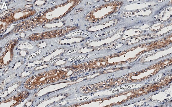 Anti-KIF5B Antibody, clone 2F23 ZooMAb&#174; Rabbit Monoclonal recombinant, expressed in HEK 293 cells