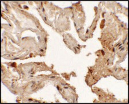 Anti-NKX2-1 antibody produced in rabbit affinity isolated antibody