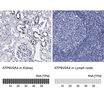 Anti-ATP6V0A4 antibody produced in rabbit Prestige Antibodies&#174; Powered by Atlas Antibodies, affinity isolated antibody, buffered aqueous glycerol solution