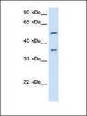 Anti-CYP2D6 antibody produced in rabbit IgG fraction of antiserum