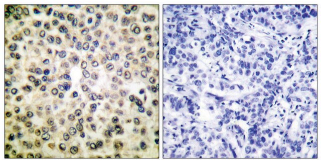 Anti-NF-&#954;B p65 antibody produced in rabbit affinity isolated antibody