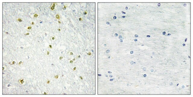 Anti-SNAPC5 antibody produced in rabbit affinity isolated antibody