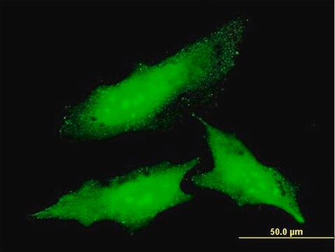 Monoclonal Anti-ODC1 antibody produced in mouse clone 2G5, purified immunoglobulin, buffered aqueous solution