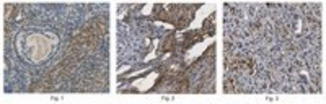 Anti-HSD17B7 Antibody