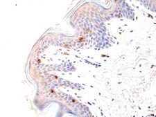 Anti-CD1a Rabbit Monoclonal Antibody clone RM393, affinity purified immunoglobulin