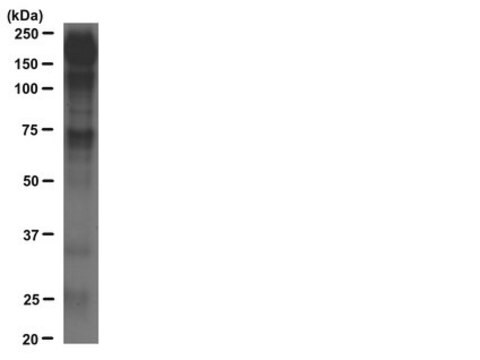 4G10&#174; Platinum, Anti-Phosphotyrosine Antibody, Agarose Conjugate clone 4G10®, Upstate&#174;, from mouse