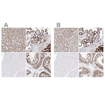 Anti-PDIA5 antibody produced in rabbit Prestige Antibodies&#174; Powered by Atlas Antibodies, affinity isolated antibody, buffered aqueous glycerol solution, ab3