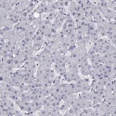 Anti-KCNH1 antibody produced in rabbit Prestige Antibodies&#174; Powered by Atlas Antibodies, affinity isolated antibody, buffered aqueous glycerol solution