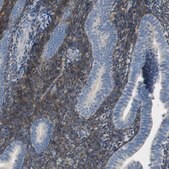 Anti-ALDH1A2 antibody produced in rabbit Prestige Antibodies&#174; Powered by Atlas Antibodies, affinity isolated antibody, buffered aqueous glycerol solution