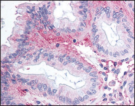 Anti-GPR81/FKSG80 (AB2) antibody produced in rabbit affinity isolated antibody, buffered aqueous solution