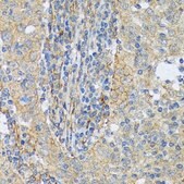 Anti-Cortactin antibody produced in rabbit