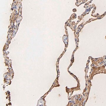 Anti-PAG1 antibody produced in rabbit Prestige Antibodies&#174; Powered by Atlas Antibodies, affinity isolated antibody, buffered aqueous glycerol solution