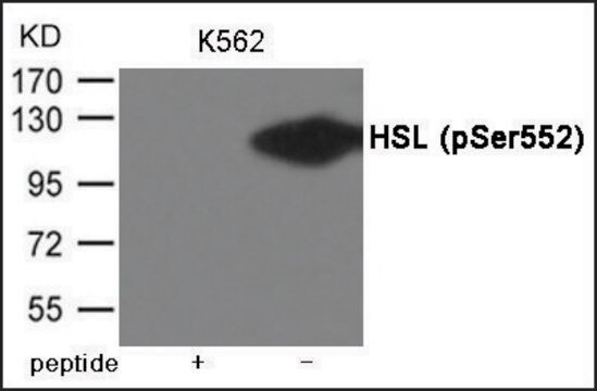 Anti-phospho-HSL (pSer552) antibody produced in rabbit affinity isolated antibody