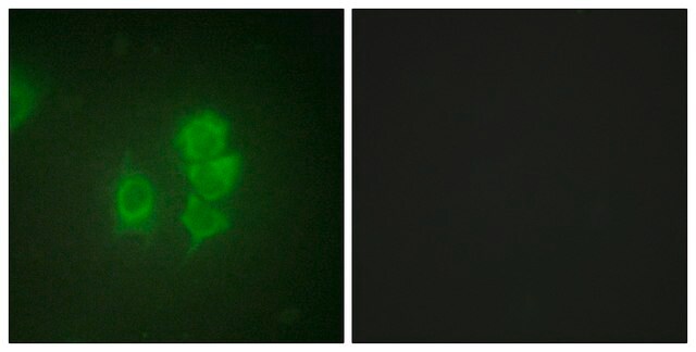 Anti-MSK1 antibody produced in rabbit affinity isolated antibody