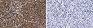 Anti-Skp2 Antibody, clone 1B13 ZooMAb&#174; Rabbit Monoclonal recombinant, expressed in HEK 293 cells