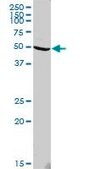 Anti-TUBA1B antibody produced in rabbit purified immunoglobulin, buffered aqueous solution