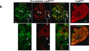 Monoclonal Anti-Insulin antibody produced in mouse clone K36AC10, ascites fluid