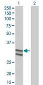 Monoclonal Anti-SERPINC1 antibody produced in mouse clone 2B12, ascites fluid