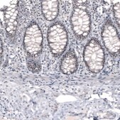 Monoclonal Anti-NIFK antibody produced in mouse Prestige Antibodies&#174; Powered by Atlas Antibodies, clone CL2240, purified immunoglobulin, buffered aqueous glycerol solution