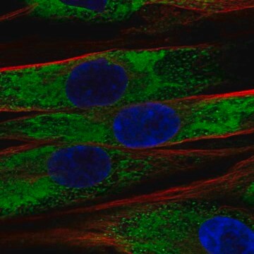 Anti-Col1A2 Antibody Produced In Rabbit Prestige Antibodies&#174; Powered by Atlas Antibodies, affinity isolated antibody, buffered aqueous glycerol solution