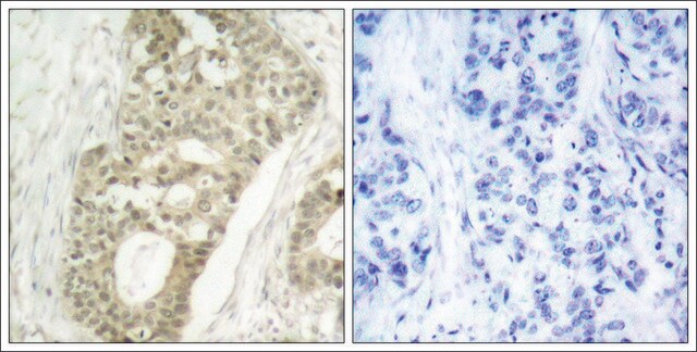 Anti-phospho-PRKCD (pSer645) antibody produced in rabbit affinity isolated antibody