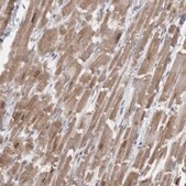 Anti-CAMK2D antibody produced in rabbit Prestige Antibodies&#174; Powered by Atlas Antibodies, affinity isolated antibody, buffered aqueous glycerol solution