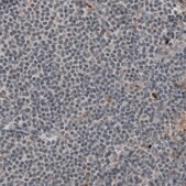Monoclonal Anti-LAMA1 antibody produced in mouse Prestige Antibodies&#174; Powered by Atlas Antibodies, clone CL2968, purified immunoglobulin, buffered aqueous glycerol solution