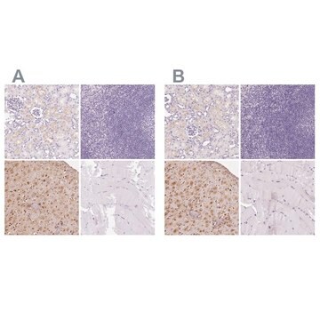 Anti-IGFBP1 antibody produced in rabbit Prestige Antibodies&#174; Powered by Atlas Antibodies, affinity isolated antibody, buffered aqueous glycerol solution