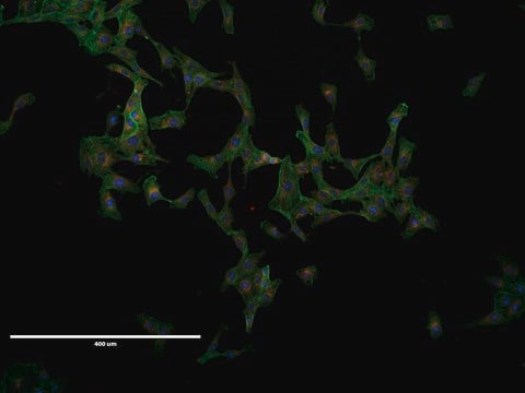 VERO Cell Line NOTE: Both the cell line and DNA from the cell line may be available for this product. Please choose -1VL or VIAL for cells, or -DNA-5UG for DNA, 84113001, African green monkey kidney, Fibroblast-like