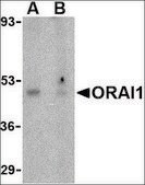 Anti-ORAI1 antibody produced in rabbit affinity isolated antibody, buffered aqueous solution