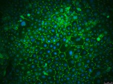 16HBE14o- Human Bronchial Epithelial Cell Line 16HBE14o- human bronchial epithelial cell line is widely used to model barrier function of the airway epithelium and to study respiratory ion transport as well as the function of CFTR.