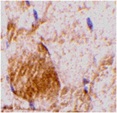 Anti-IL-31 Antibody from rabbit, purified by affinity chromatography