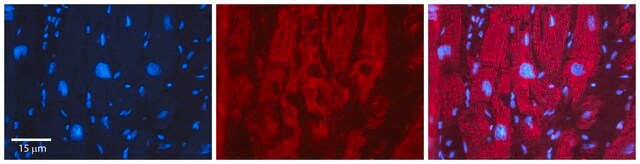 Anti-EFEMP1 antibody produced in rabbit affinity isolated antibody