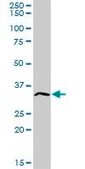 Anti-ATP4B antibody produced in rabbit purified immunoglobulin, buffered aqueous solution