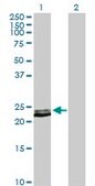 Anti-PRL antibody produced in rabbit purified immunoglobulin, buffered aqueous solution
