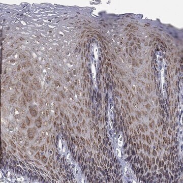 Anti-Ticam1 Antibody Produced In Rabbit Prestige Antibodies&#174; Powered by Atlas Antibodies, affinity isolated antibody, buffered aqueous glycerol solution