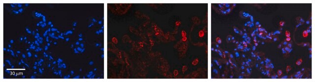 Anti-DEGS1 antibody produced in rabbit affinity isolated antibody