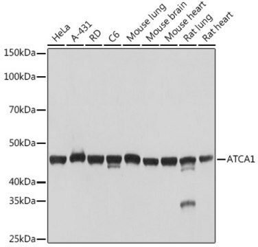 Anti-&#945;-Actin-1 (ACTA1) Antibody, clone 8T8D0, Rabbit Monoclonal