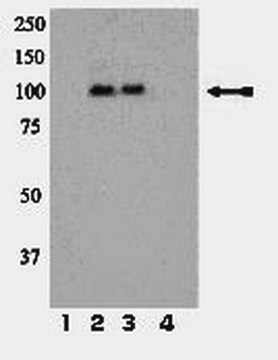 Anti-phospho-IR/IGF1R (Tyr1158/Tyr1162/Tyr1163) Antibody Upstate&#174;, from rabbit