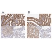 Anti-ADA antibody produced in rabbit Prestige Antibodies&#174; Powered by Atlas Antibodies, affinity isolated antibody, buffered aqueous glycerol solution