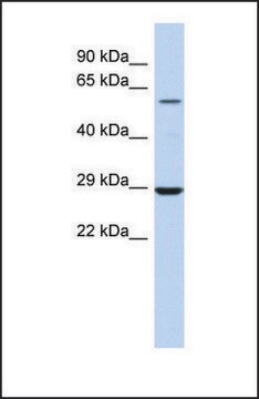 Anti-LPCAT1 antibody produced in rabbit affinity isolated antibody