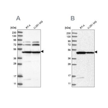 Anti-HADHB antibody produced in rabbit Prestige Antibodies&#174; Powered by Atlas Antibodies, affinity isolated antibody, buffered aqueous glycerol solution